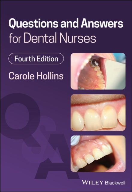 Book cover of: Questions and Answers for Dental Nurses. By: Carole Hollins