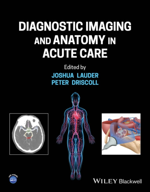 Book cover of: Diagnostic Imaging and Anatomy in Acute Care. By: Joshua Lauder