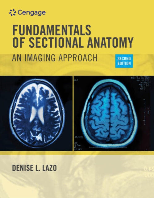 Book cover of: Workbook for Lazo's Fundamentals of Sectional Anatomy: An Imaging Approach, 2nd. By: Denise L. Lazo