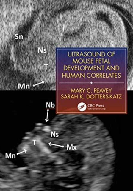 Book cover of: Ultrasound of Mouse Fetal Development and Human Correlates. By: Mary C. Peavey