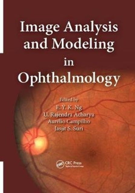 Book cover of: Image Analysis and Modeling in Ophthalmology. By: Eddie Y. K. Ng