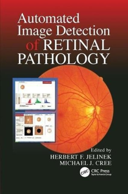 Book cover of: Automated Image Detection of Retinal Pathology. By: Herbert Jelinek