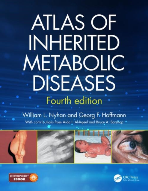 Book cover of: Atlas of Inherited Metabolic Diseases. By: William L. Nyhan