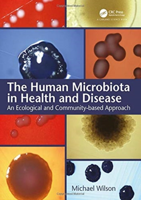 Book cover of: Human Microbiota in Health and Disease. By: Michael Wilson