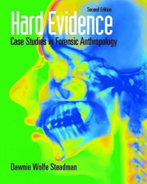 Book cover of: Hard Evidence. By: Dawnie Wolfe Steadman