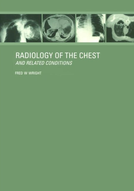 Book cover of: Radiology of the Chest and Related Conditions. By: F. W. Wright