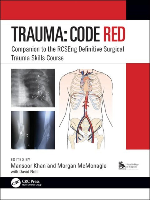 Book cover of: Trauma: Code Red. By: Mansoor Khan
