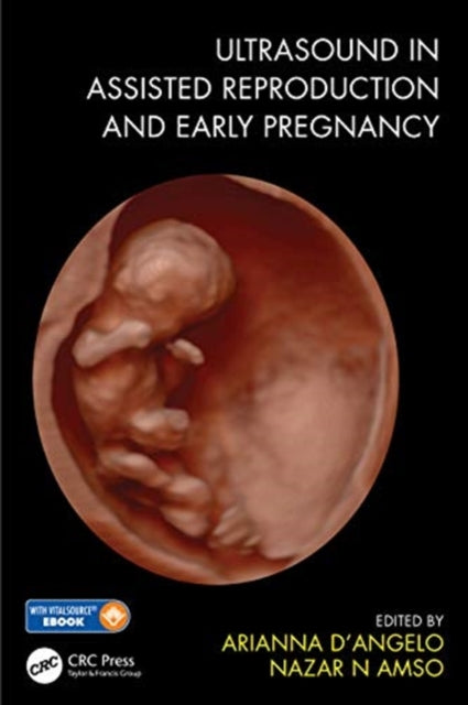 Book cover of: Ultrasound in Assisted Reproduction and Early Pregnancy. By: Nazar Amso
