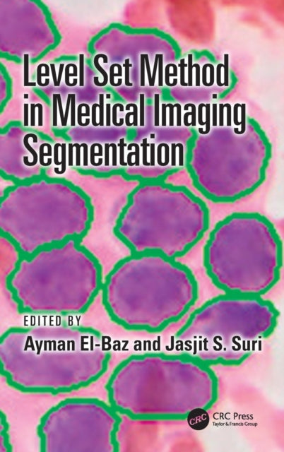 Book cover of: Level Set Method in Medical Imaging Segmentation. By: Ayman S. El-Baz