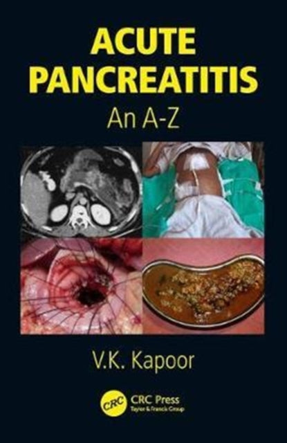 Book cover of: Acute Pancreatitis. By: V.K. Kapoor