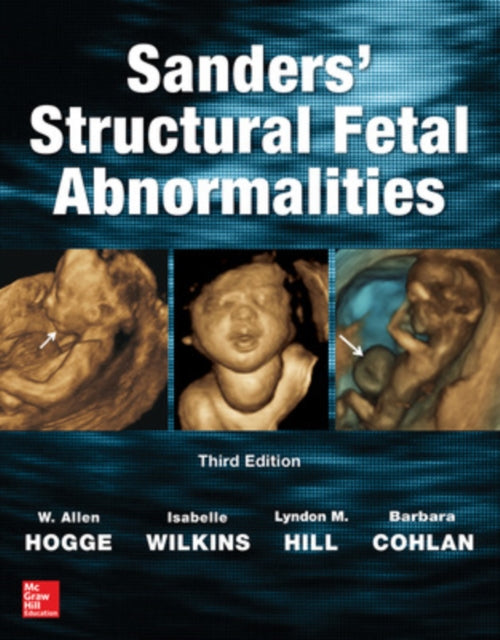 Book cover of: Sanders' Structural Fetal Abnormalities, Third Edition. By: W. Allen Hogge