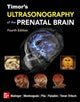 Book cover of: Timor's Ultrasonography of the Prenatal Brain, Fourth Edition. By: Gianluigi Pilu