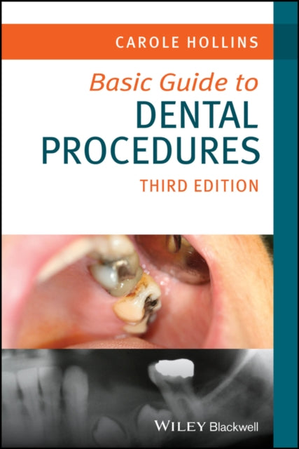 Book cover of: Basic Guide to Dental Procedures. By: Carole Hollins