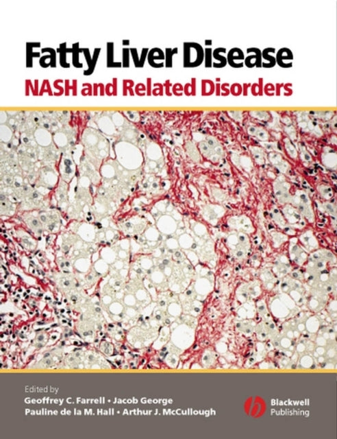 Book cover of: Fatty Liver Disease. By: Jacob George