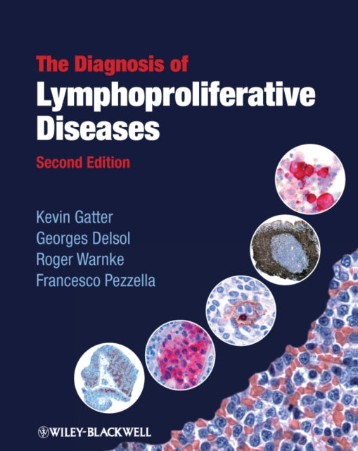 Book cover of: Diagnosis of Lymphoproliferative Diseases