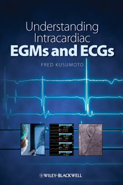 Book cover of: Understanding Intracardiac EGMs and ECGs. By: Fred Kusumoto