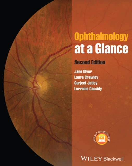 Book cover of: Ophthalmology at a Glance. By: Jane Olver