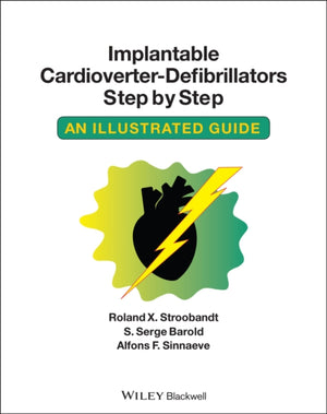Implanteeritav kardioverter - defibrillaatorid samm-sammult