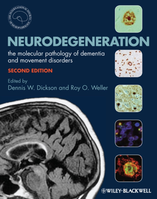 Book cover of: Neurodegeneration. By: Dennis Dickson
