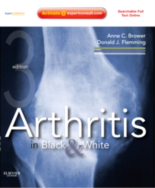 Book cover of: Arthritis in Black and White. By: Anne C. Brower