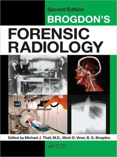 Book cover of: Brogdon's Forensic Radiology. By: Michael J. Thali