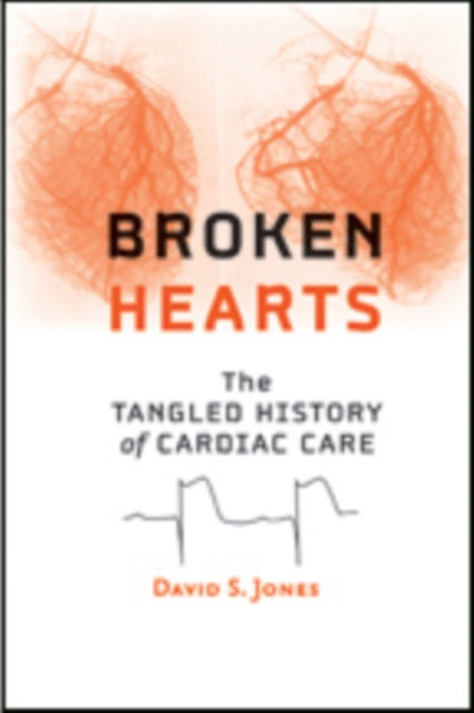 Book cover of: Broken Hearts. By: David S. Jones