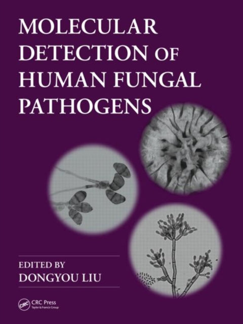 Book cover of: Molecular Detection of Human Fungal Pathogens. By: Dongyou Liu