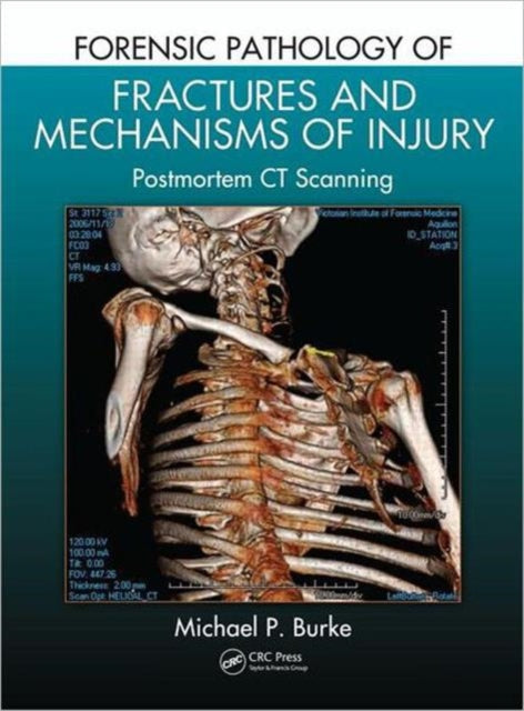 Book cover of: Forensic Pathology of Fractures and Mechanisms of Injury. By: Michael P. Burke