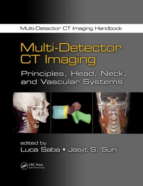Book cover of: Multi-Detector CT Imaging