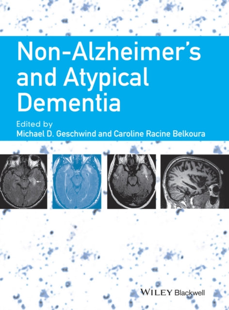 Book cover of: Non-Alzheimer's and Atypical Dementia. By: Michael D. Geschwind