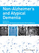 Book cover of: Non-Alzheimer's and Atypical Dementia. By: Michael D. Geschwind