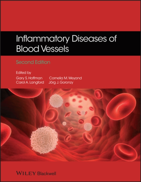 Book cover of: Inflammatory Diseases of Blood Vessels. By: Gary S. Hoffman