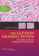 Book cover of: Gleason Grading System. By: Jonathan I. Epstein