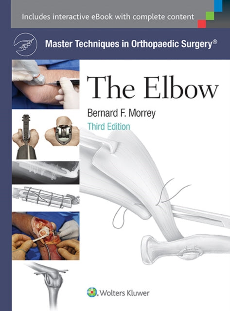Book cover of: Master Techniques in Orthopaedic Surgery: The Elbow. By: Bernard F. Morrey