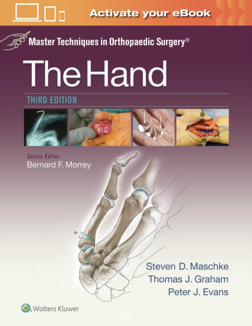 Book cover of: Master Techniques in Orthopaedic Surgery: The Hand. By: Thomas J. Graham