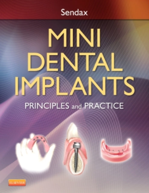 Book cover of: Mini Dental Implants