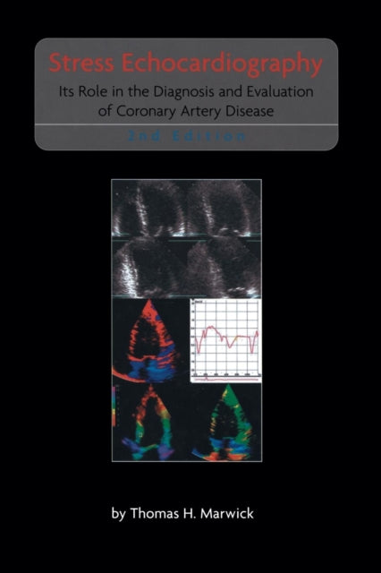 Book cover of: Stress Echocardiography. By: Thomas H. Marwick