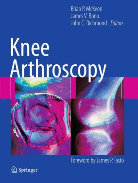 Book cover of: Knee Arthroscopy. By: Brian McKeon