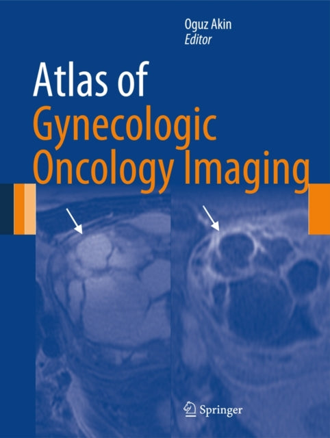 Book cover of: Atlas of Gynecologic Oncology Imaging
