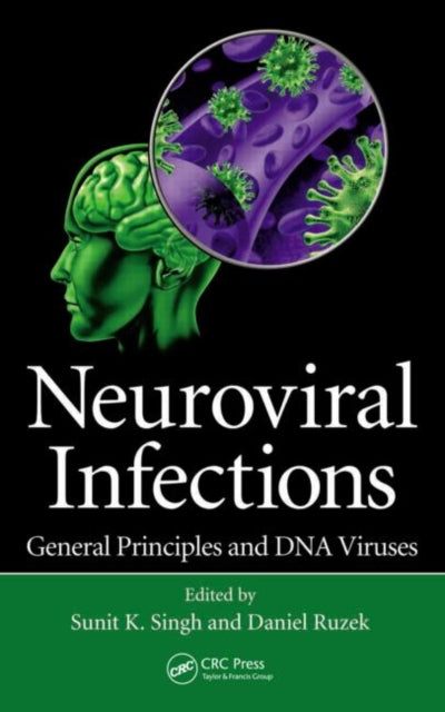 Book cover of: Neuroviral Infections. By: Sunit K. Singh