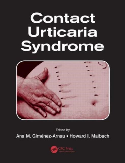 Book cover of: Contact Urticaria Syndrome. By: Ana M. Gimenez-Arnau