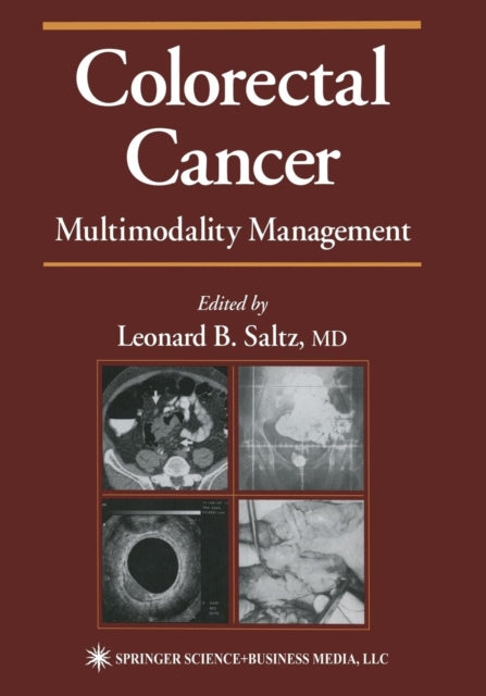 Book cover of: Colorectal Cancer. By: Leonard B. Saltz