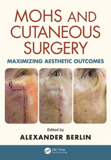 Book cover of: Mohs and Cutaneous Surgery. By: Alexander Berlin