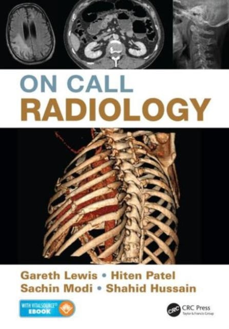 Book cover of: On Call Radiology. By: Gareth Lewis