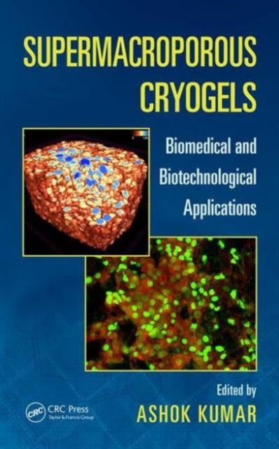 Book cover of: Supermacroporous Cryogels. By: Ashok Kumar