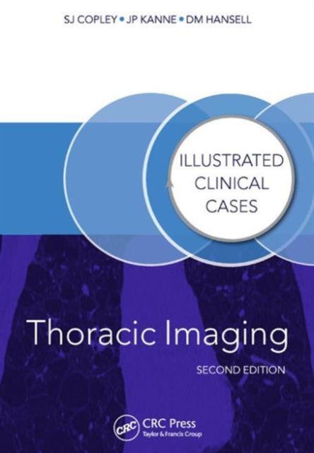 Book cover of: Thoracic Imaging. By: Sue Copley