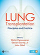 Book cover of: Lung Transplantation. By: Wickii Vigneswaran