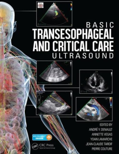 Book cover of: Basic Transesophageal and Critical Care Ultrasound. By: Andre Denault