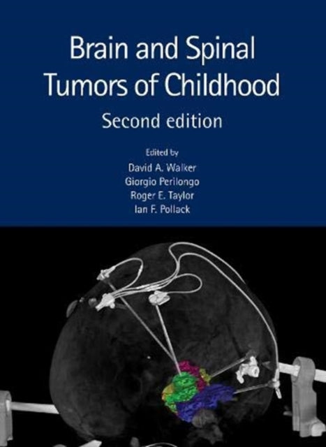 Book cover of: Brain and Spinal Tumors of Childhood. By: Walker, David A.