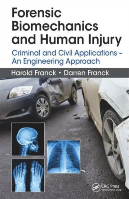 Book cover of: Forensic Biomechanics and Human Injury. By: Harold Franck